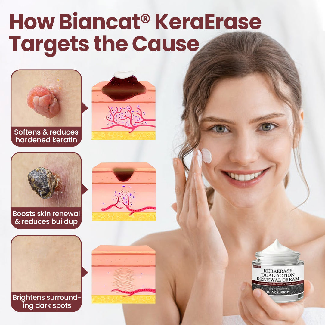 Halsen®KeraErase Dual-Action Renewal Cream