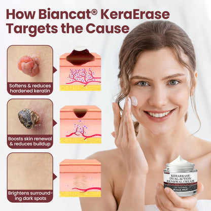 Halsen®KeraErase Dual-Action Renewal Cream