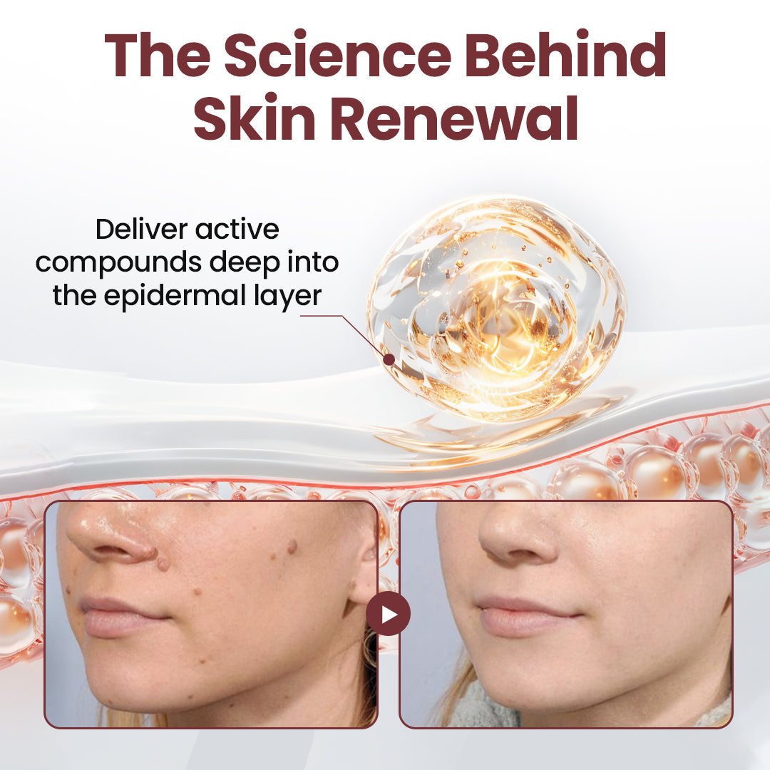 Halsen®KeraErase Dual-Action Renewal Cream