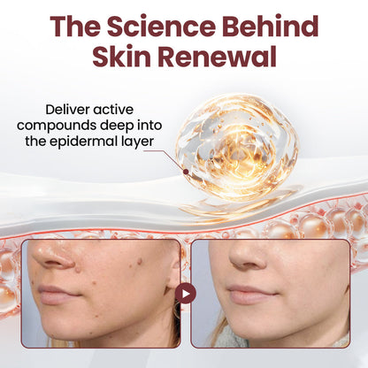 Halsen®KeraErase Dual-Action Renewal Cream