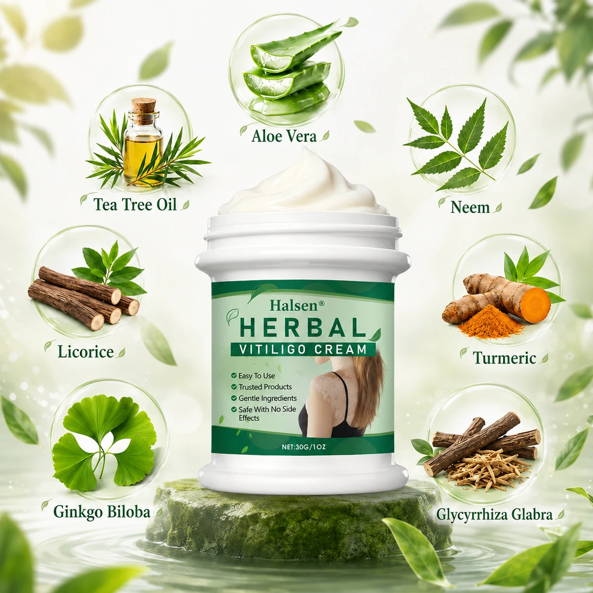 Halsen® Herbal Vitiligo Cream🔥