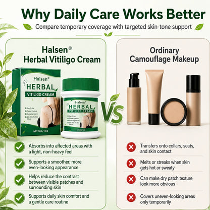 Halsen® Herbal Vitiligo Cream🔥